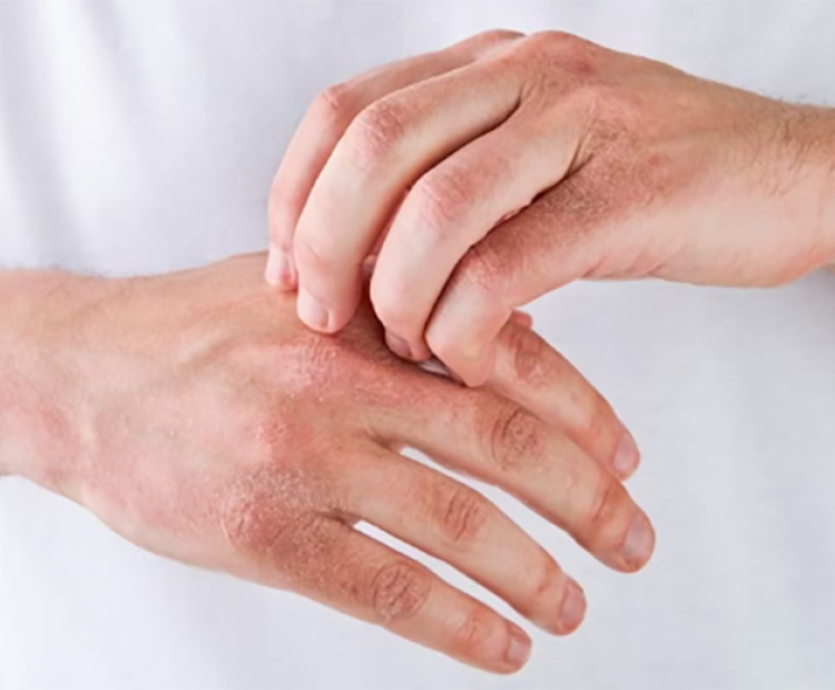 Bakkerseczeem, part of the job?